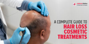 A COMPLETE GUIDE TO HAIR LOSS COSMETIC TREATMENTS