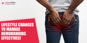 LIFESTYLE CHANGES TO MANAGE HAEMORRHOIDS EFFECTIVELY
