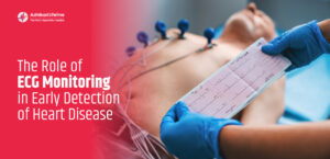 The Role of ECG Monitoring in Early Detection of Heart Disease