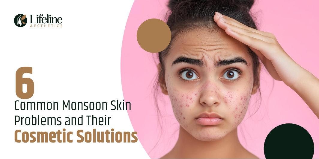 6 Common Monsoon Skin Problems and Their Cosmetic Solutions