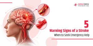 warning signs of a stroke